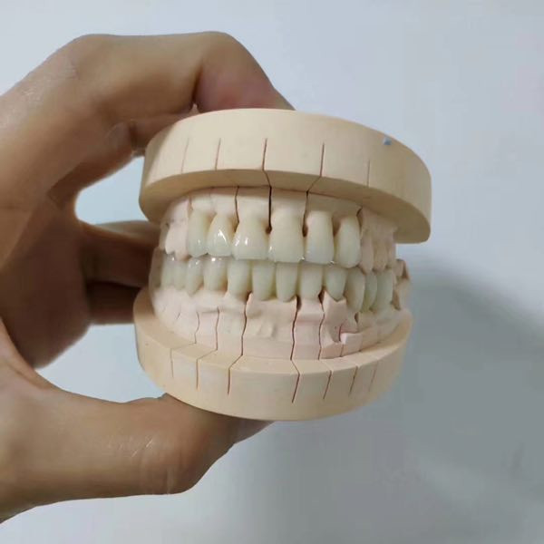 Zirconia Block Application Case