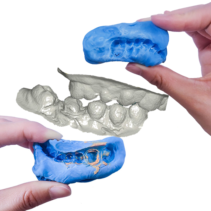  3D scanner dental